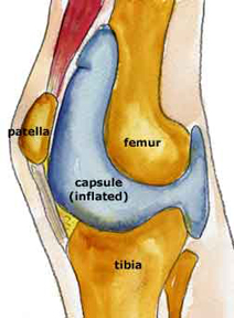 joint_cavity02c.jpg